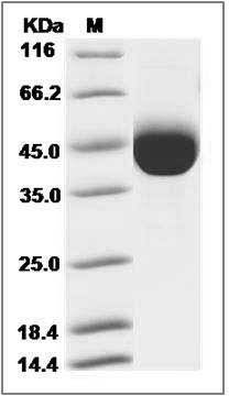 Influenza A H7N9 (A/Pigeon/Shanghai/S1069/2013) Hemagglutinin Protein (HA1 Subunit) (His Tag) SDS-PAGE