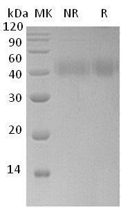 Human IL20RA/UNQ681/PRO1315 (His tag) recombinant protein