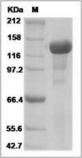 Mouse EGF / Epidermal growth factor Protein (His Tag) SDS-PAGE