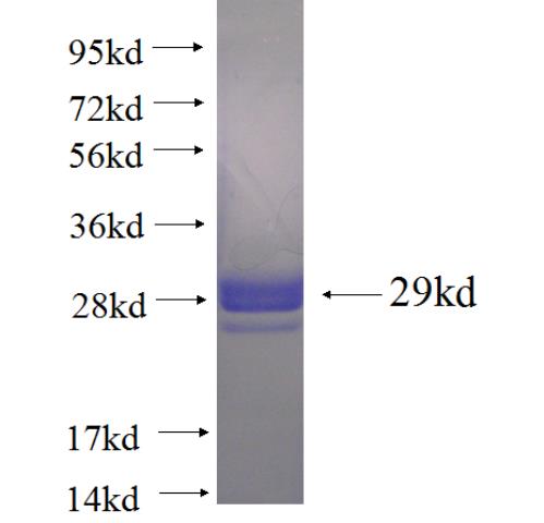 Recombinant human BOD1 SDS-PAGE