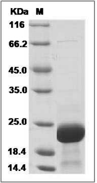 Human STMN1 / Stathmin 1 Protein (His Tag) SDS-PAGE