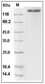 Human ACE2 / Angiotensin-Converting Enzyme 2 (Fc Tag) recombinant protein