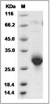 Rat CLM-9 / TREM4 / CD300LG Protein (His Tag) SDS-PAGE