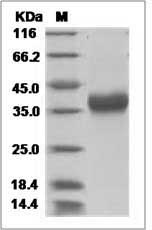Human HS3ST1 Protein (His Tag) SDS-PAGE