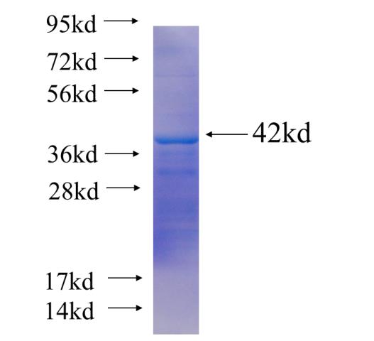 Recombinant human DOK3(Full length) SDS-PAGE