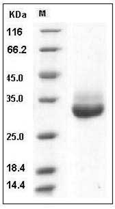 Human KLK-4 / Kallikrein-4 Protein (His Tag) SDS-PAGE