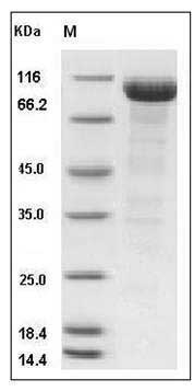 Human Alkaline Phosphatase / ALPI Protein (Fc Tag) SDS-PAGE