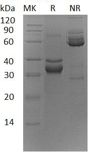 Mouse Tnfrsf12a/Fgfrp2/Fn14 (Fc tag) recombinant protein