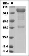 Human RPN2 / Ribophorin II Protein (Fc Tag) SDS-PAGE