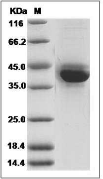 Mouse S100A4 Protein (Fc Tag) SDS-PAGE