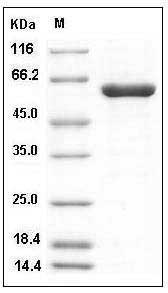 Human PTPN2 / TC-PTP Protein (aa 1-314, His & GST Tag) SDS-PAGE