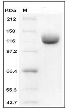Human ANPEP / CD13 Protein (603 Met/Ile, His Tag) SDS-PAGE