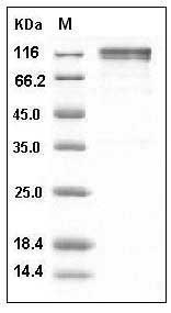 Human CD45 / PTPRC Protein (Fc Tag) SDS-PAGE