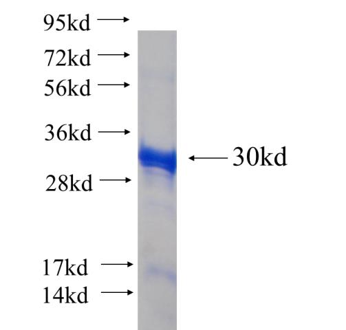 Recombinant human RAB23 SDS-PAGE