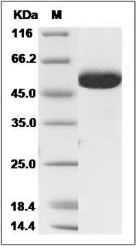 Human B3GALTL Protein (His Tag) SDS-PAGE