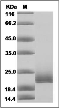 Human CD16b / FCGR3B Protein, Biotinylated
