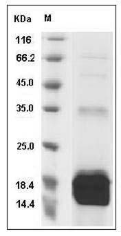 Mouse S100A9 / CAGB / p14 Protein (His Tag) SDS-PAGE