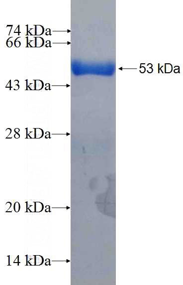 Recombinant Human PEX26 SDS-PAGE