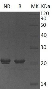 Human HSPB11/C1orf41/IFT25/HSPC034 (His tag) recombinant protein