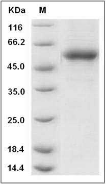 Rat TNFSF15 / TL1A Protein (Fc Tag) SDS-PAGE