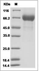 Influenza A H3N2 (A/New York/55/2004) Hemagglutinin / HA1 Protein (His Tag)