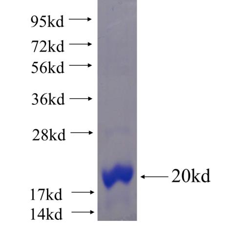 Recombinant human FAM134C SDS-PAGE