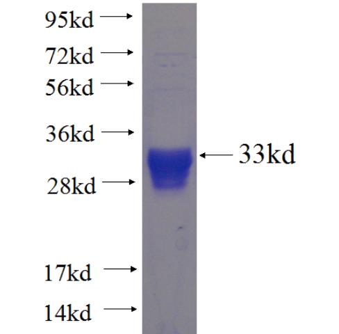 Recombinant human WISP3 SDS-PAGE