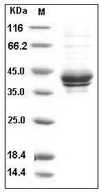 Human I-309 / CCL1 / TCA-3 Protein (Fc Tag) SDS-PAGE
