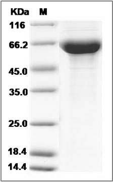 Human PGRL / IGSF8 Protein (His Tag) SDS-PAGE