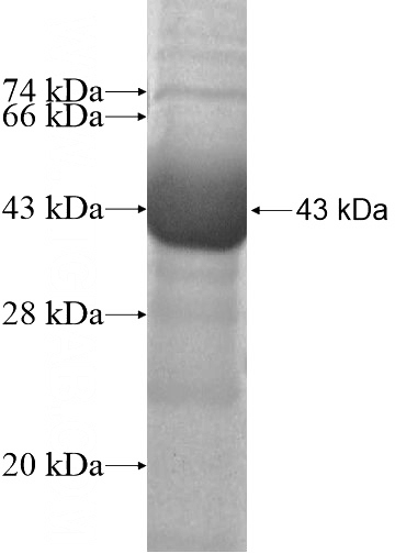 Recombinant Human ATP1A2 SDS-PAGE