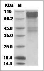 Ebola virus EBOV (subtype Bundibugyo, strain Uganda 2007) GP1 / Glycoprotein Protein (His Tag)