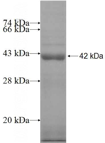 Recombinant Human NMT2 SDS-PAGE