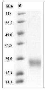 Mouse SCF / C-kit ligand Protein (His Tag) SDS-PAGE