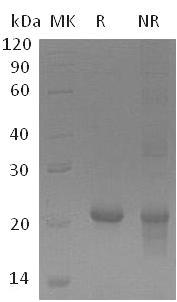 Human GADD45G/CR6/DDIT2 (His tag) recombinant protein