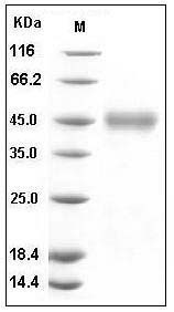 Human CD84 Protein (His Tag) SDS-PAGE