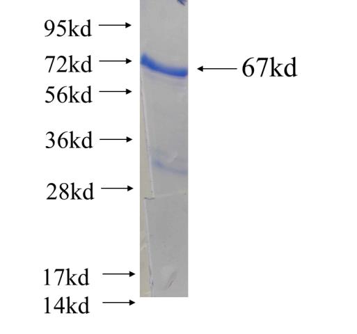 Recombinant human LPCAT2 SDS-PAGE