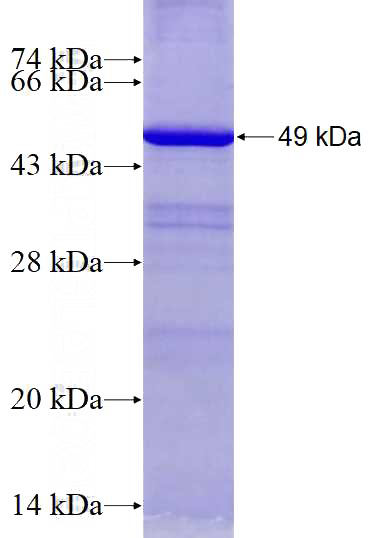Recombinant Human GSDMB SDS-PAGE