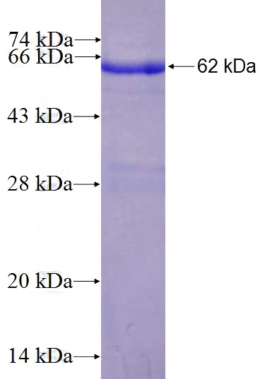 Recombinant Human TYMS SDS-PAGE