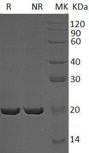 Human CRYAA/CRYA1/HSPB4 (His tag) recombinant protein
