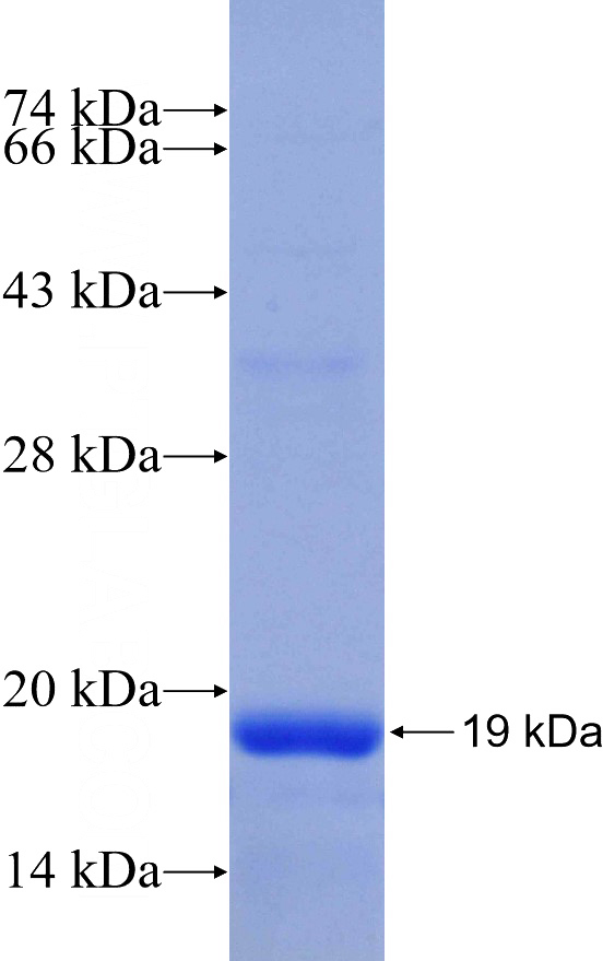 Recombinant Human ABCE1 SDS-PAGE
