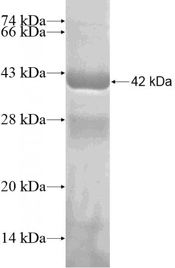 Recombinant Human C1orf26 SDS-PAGE