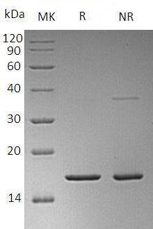 Human FGF2/FGFB recombinant protein