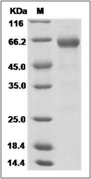 Influenza A H10N3 (A/mallard/Minnesota/Sg-00194/2007) Hemagglutinin / HA Protein (His Tag) SDS-PAGE