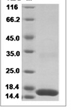 Rabbit IL17A/IL-17A/IL17 Protein 15082