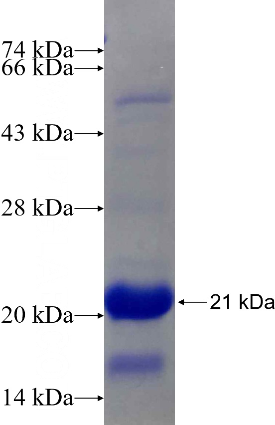 Recombinant Human MED21 SDS-PAGE