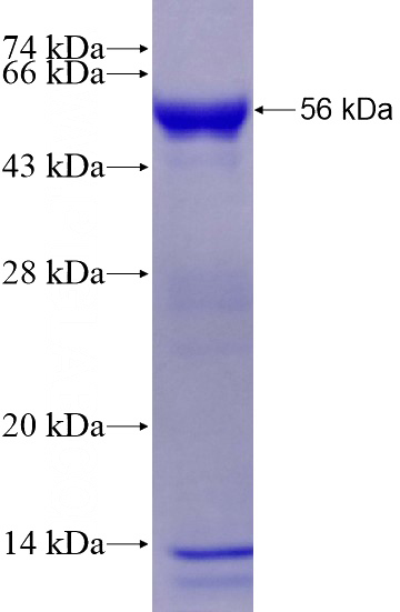 Recombinant Human CCDC83 SDS-PAGE