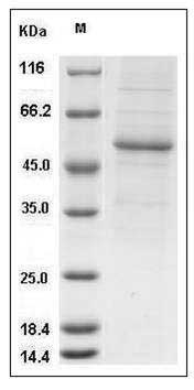 Human Interferon alpha 10 / IFNA10 Protein (Fc Tag) SDS-PAGE