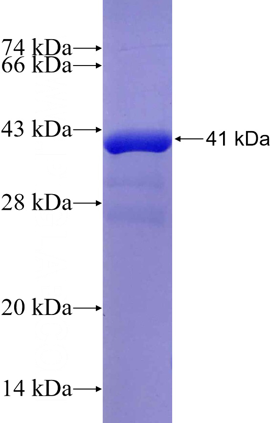 Recombinant Human FOXP4 SDS-PAGE