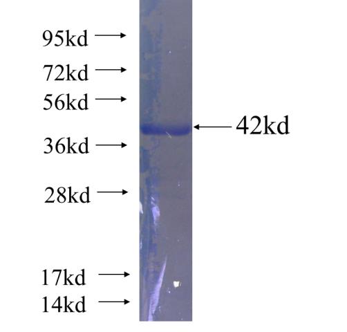 Recombinant human DLAT SDS-PAGE