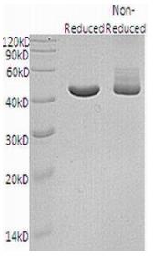 Human IDH1/PICD (His tag) recombinant protein